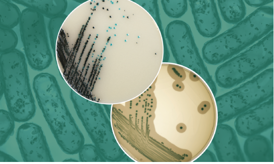 Placas de cultura e frascos de meios de cultura em bancada de laboratório microbiológico